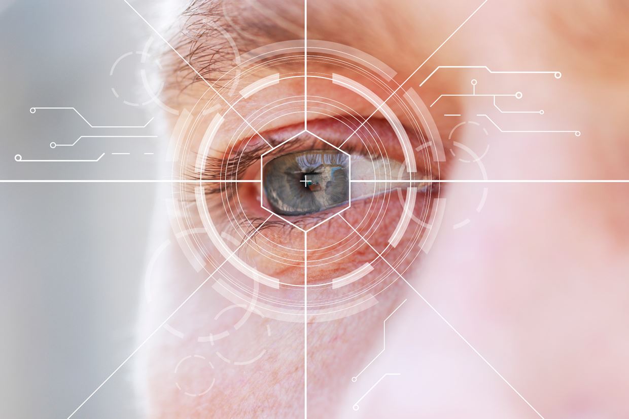 cataract